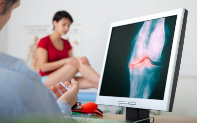 physiotherapy for osteoarthritis 2 400x250 - Resources