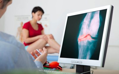 physiotherapy for osteoarthritis 2 400x250 - Shockwave Therapy