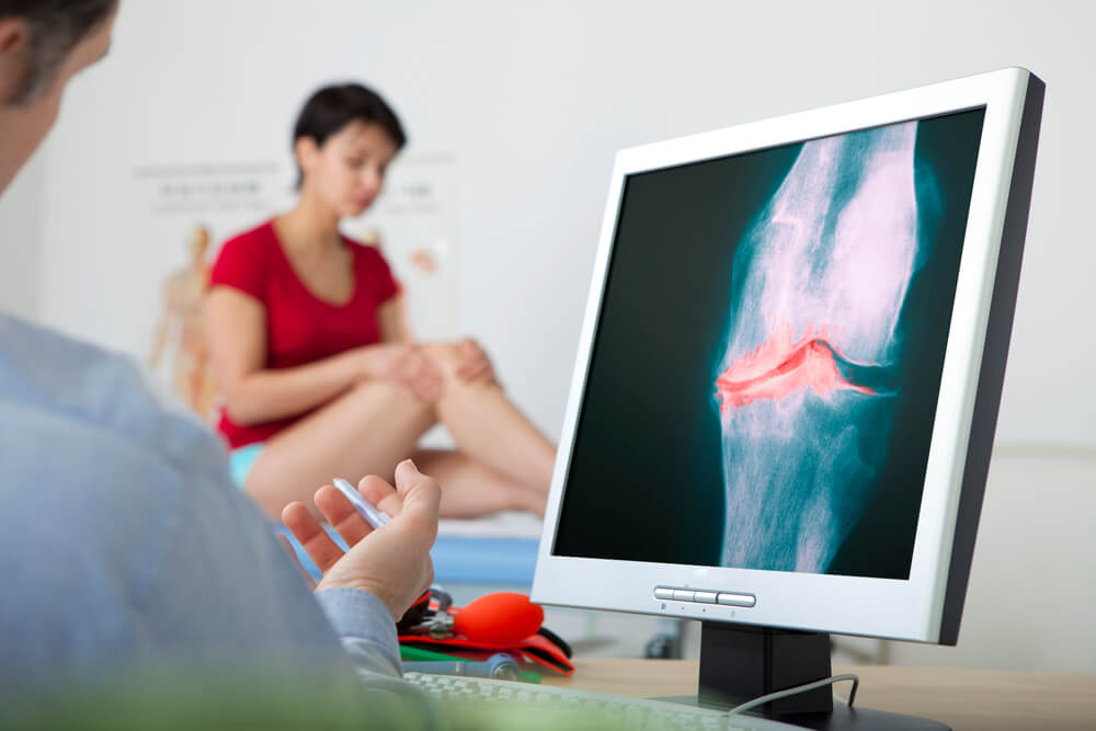 physiotherapy for osteoarthritis 2 - Using Physiotherapy for Osteoarthritis Treatment and Managing Joint Pain