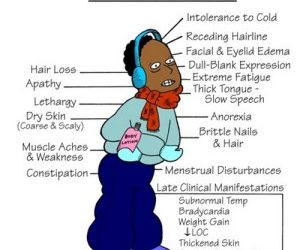 hypothyroidismsymptoms1 300x293 300x250 - Corporate Wellness