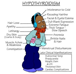 hypothyroidismsymptoms1 300x293 - Did you know we do exercises for Hypothyroidism?
